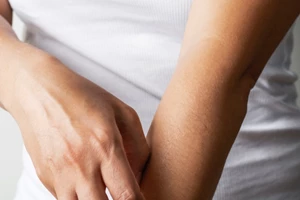 4 τρόποι να κρατήσουμε μακριά τα κουνούπια - χωρίς χημικά - εικόνα 1