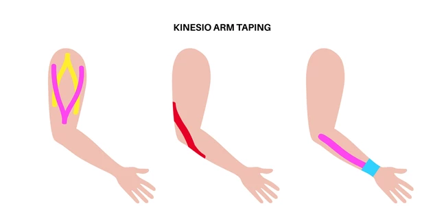 tape