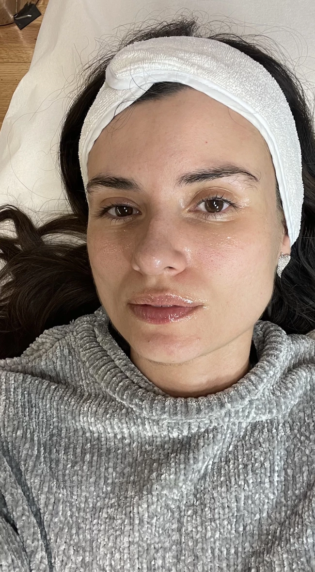 skin