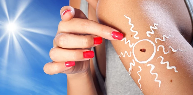 melanoma