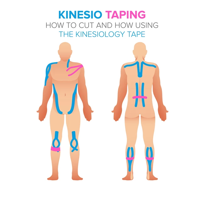 tape