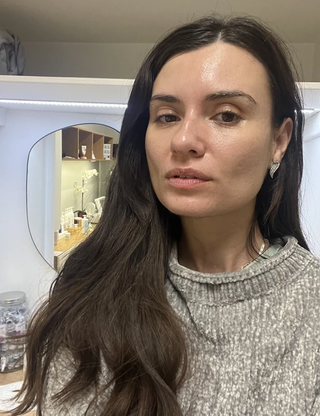 skin
