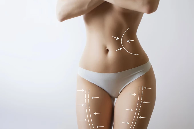 Λιποαναρρόφηση Laser SmartLipo