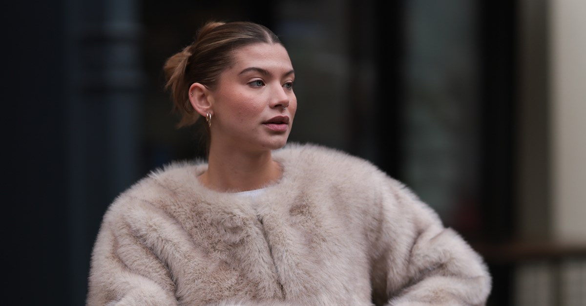 Manuka Honey: Είναι το μέλι στην επιδερμίδα μια αποτελεσματική θεραπεία για την ακμή και τα σημάδια της; - εικόνα 1