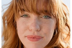 Ευρυαγγείες προσώπου: 5 εύκολοι τρόποι για να τις αντιμετωπίσεις αποτελεσματικά - εικόνα 2