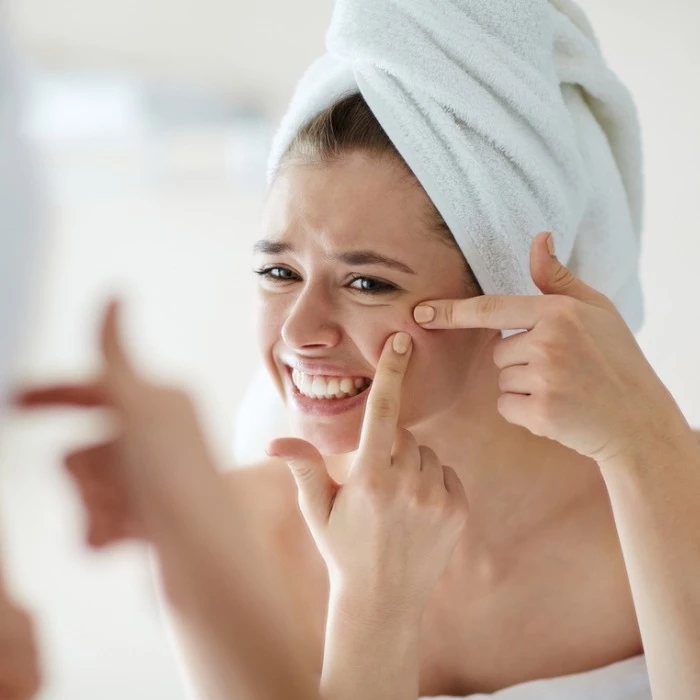 Scarlett Johansson: Πώς η ακμή ενηλίκων επηρέασε την αυτοπεποίθησή της - εικόνα 1