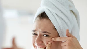 Scarlett Johansson: Πώς η ακμή ενηλίκων επηρέασε την αυτοπεποίθησή της - εικόνα 1