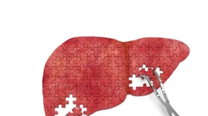 Κηλίδες Bier: Εάν παρατηρήσεις αυτά τα σημάδια στο δέρμα σου, ελέγξε το συκώτι σου - εικόνα 1