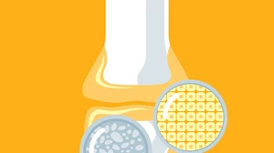 Συνέδριο EULAR: Σημαντικά αποτελέσματα νέας θεραπείας για ασθενείς με ρευματοειδή αρθρίτιδα - εικόνα 1