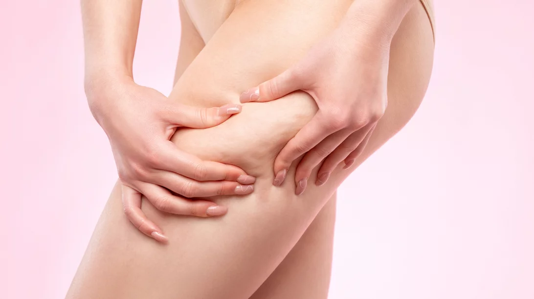 10 τροφές που δημιουργούν κυτταρίτιδα και δεν το ξέρεις!