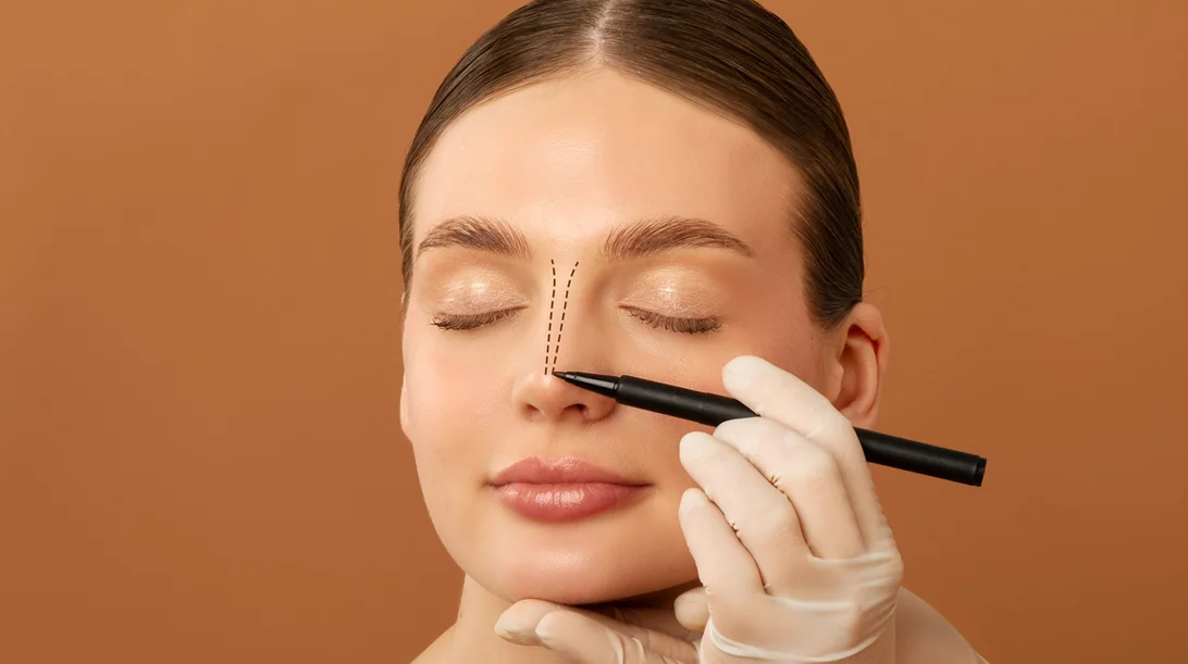 Ποιοι είναι οι λόγοι που όλο και περιοσσότεροι νέοι πριν την ηλικία των 40 κάνουν ρινοπλαστική;