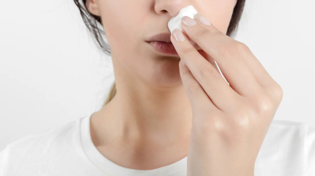 Πώς σταματάς τη ρινορραγία | Φέρνεις το κεφάλι μπροστά ή πίσω;