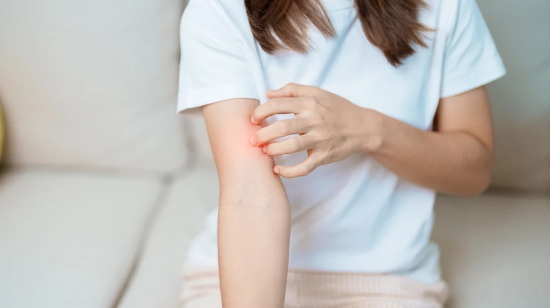 Έχεις λύκο (ΣΕΛ); Δες γιατί τα συμπτώματα μπορεί να βελτιωθούν φυσικά με το πέρασμα του χρόνου