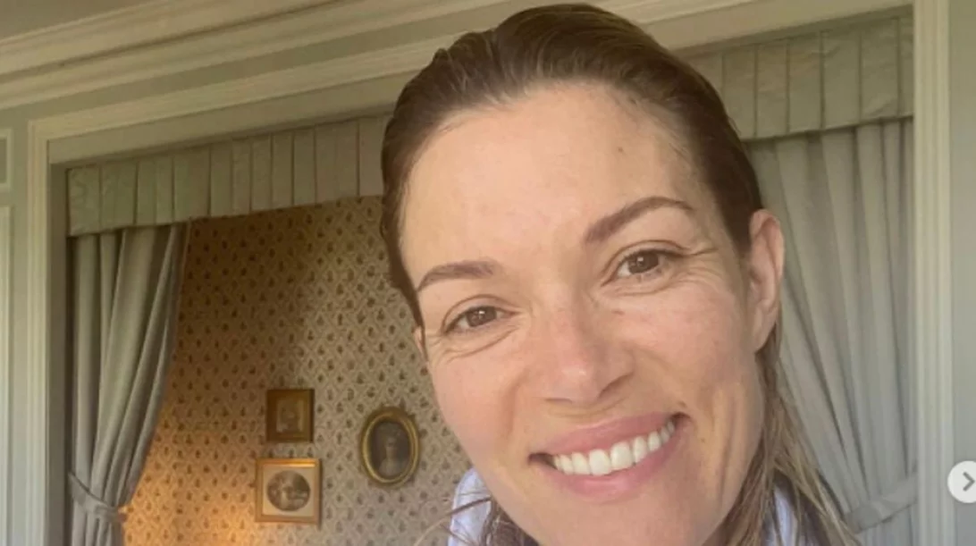 Xωρίς μακιγιάζ | Οι celebrities που ξεχνούν το foundation στις διακοπές