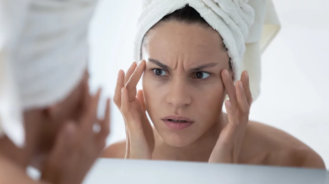 Χωρίς ενέσιμα - 5 φυσικοί τρόποι να μειώσεις τις ρυτίδες στο μέτωπο