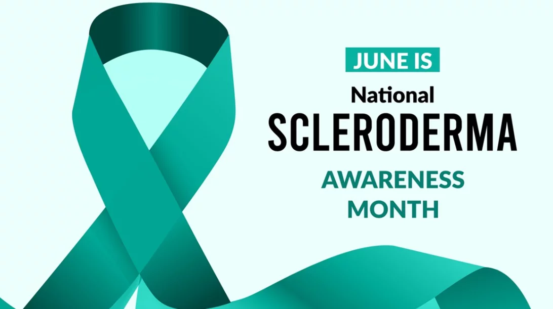 Σκληρόδερμα: Το αυτοάνοσο που "προτιμά" τις γυναίκες