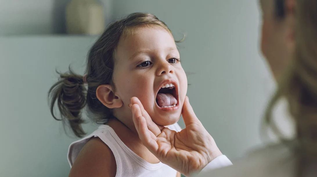 Στρεπτόκοκκος στα παιδιά: Τι να προσέχουν οι γονείς