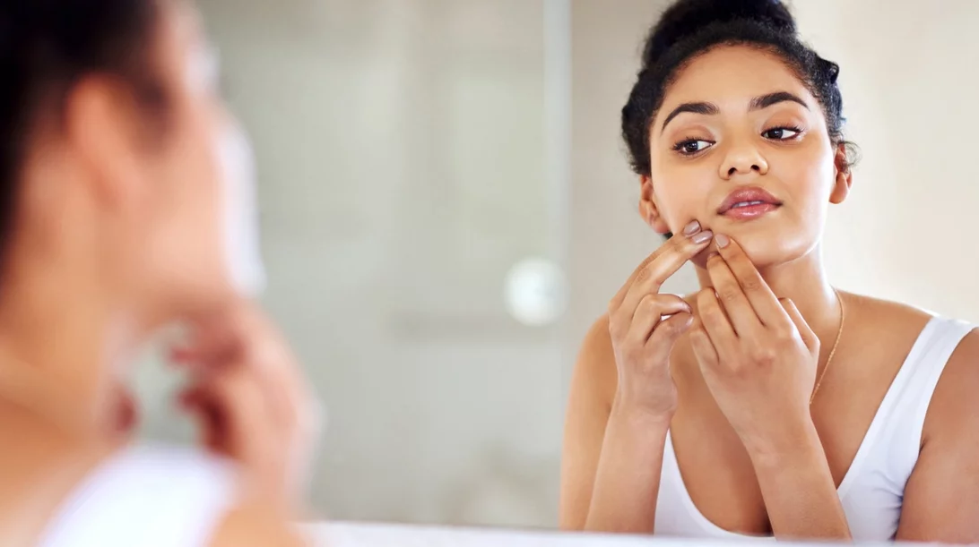 Έσπασε(ς) σπυράκι στο πρόσωπο; Τα SOS βήματα που πρέπει να ακολουθήσεις