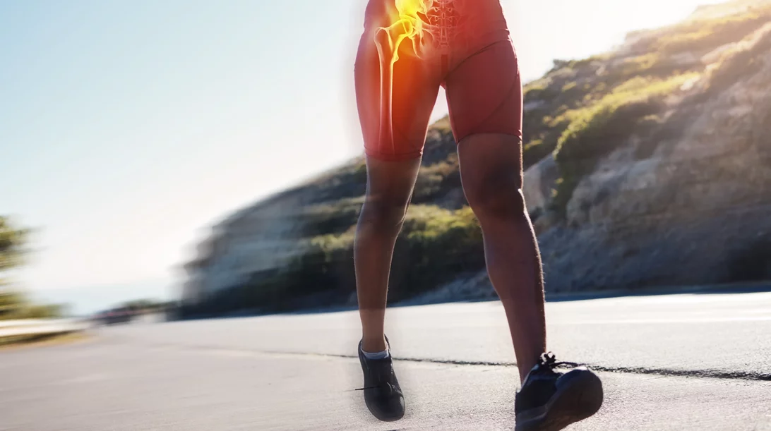 Με ποια σπορ μπορείς να ασχοληθείς μετά από αρθροπλαστική ισχίου;