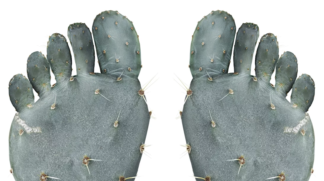 Τι αποκαλύπτουν τα δάκτυλα των ποδιών σου για την υγεία σου;