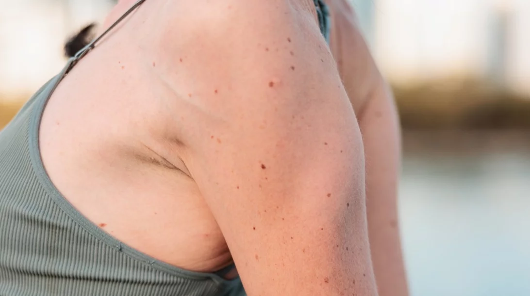 Κυρτοί ώμοι: Ίσιωσε την πλάτη με αυτές τις ασκήσεις από τη Χριστίνα Μαυρίδου