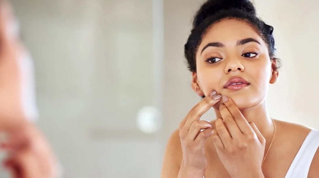 Τα μικρά άσπρα σπυράκια στο πρόσωπό σου δεν είναι (ακριβώς) ακμή