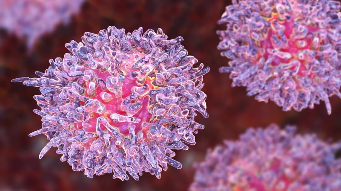 Λευχαιμία: Έγκριση νέας θεραπείας που αυξάνει το χρόνο επιβίωσης των ασθενών