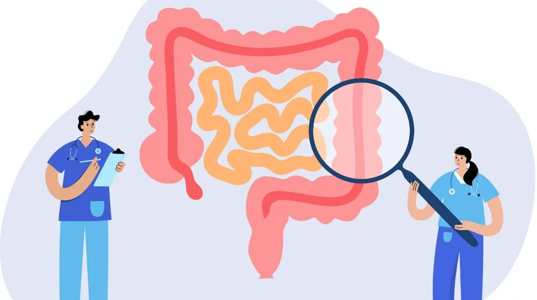 Τι είναι το self test για τον καρκίνο του εντέρου και πώς λειτουργεί