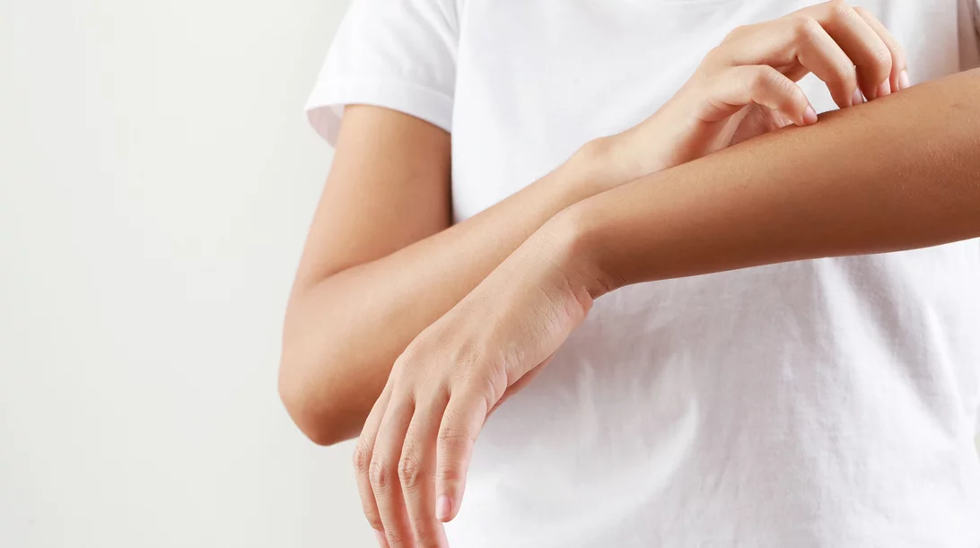 Μην τρως αυτό εάν έχεις έκζεμα, σύμφωνα με μελέτη