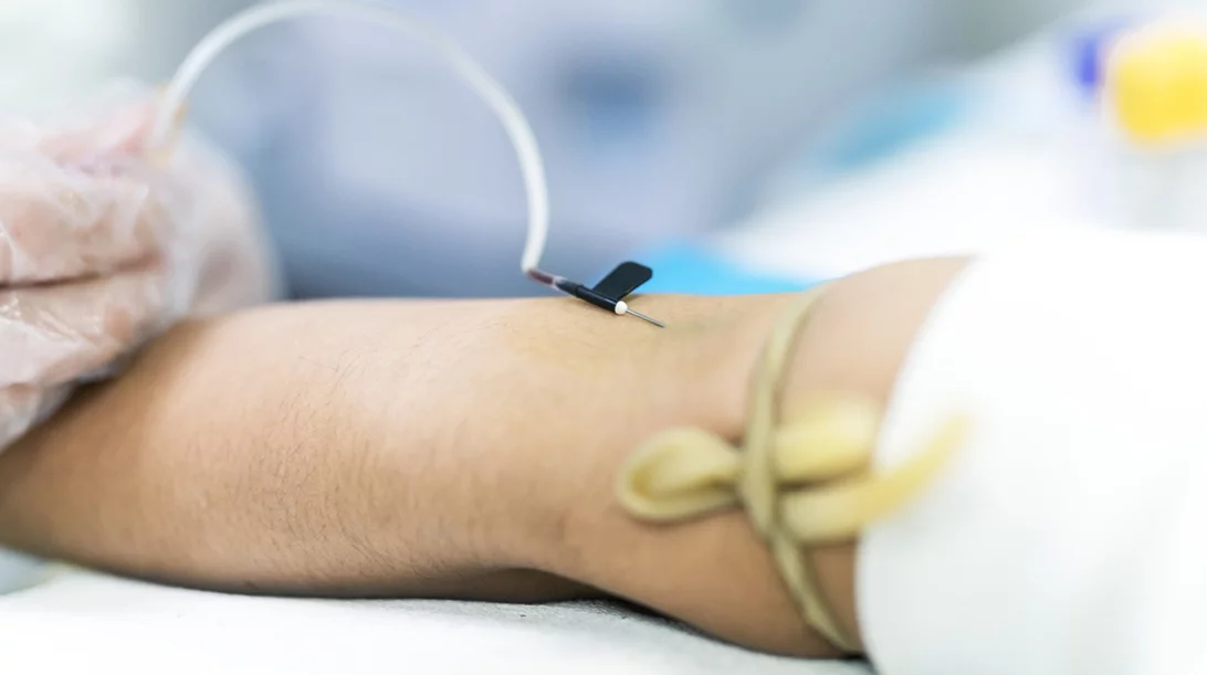 Καρκίνος του παγκρέατος: Πώς μια απλή αιμοληψία μπορεί να δώσει έγκαιρη διάγνωση;