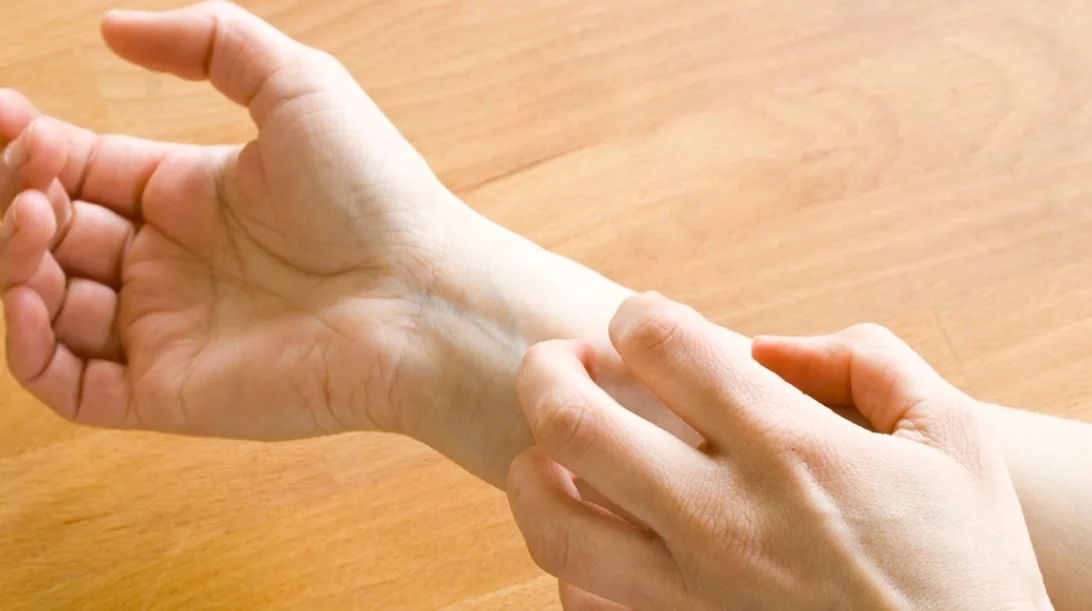 Θεραπεία για την ψωρίαση: Καλά τα νέα για τους ασθενείς με τη νόσο