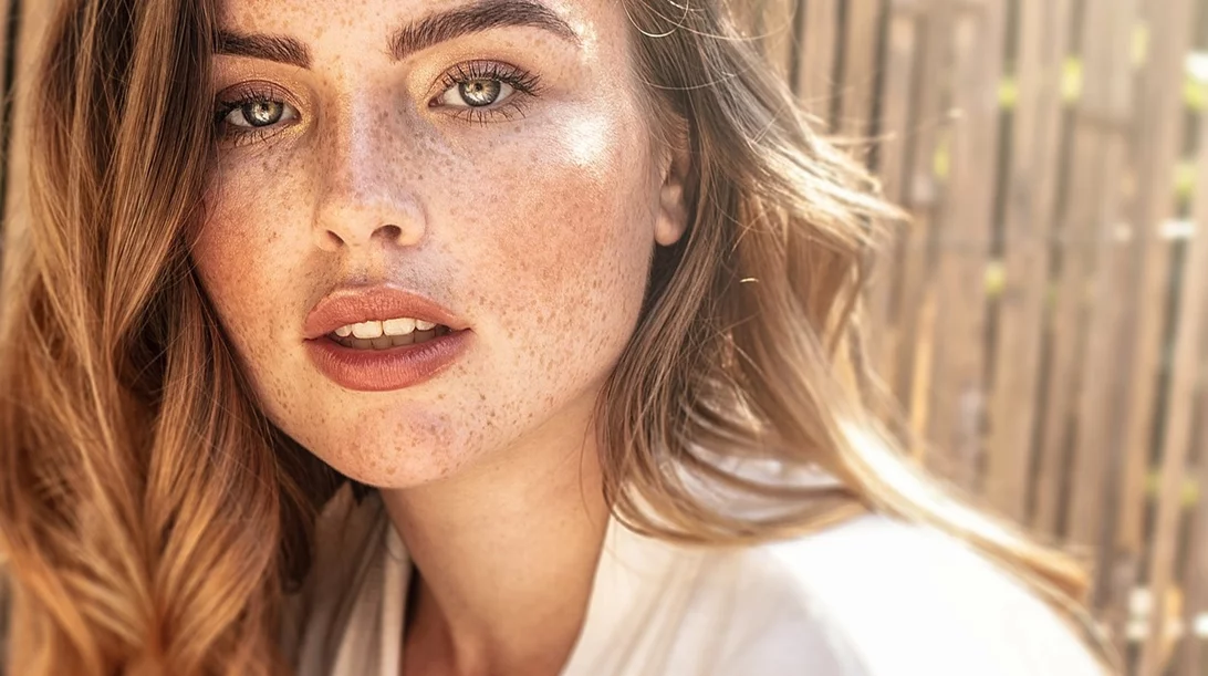 Καφέ κηλίδες: 3 αλλαγές που πρέπει οπωσδήποτε να κάνεις τώρα στη ρουτίνα σου