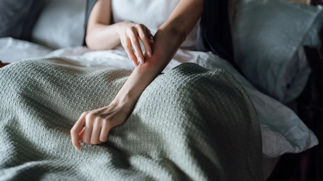 6 τρόποι για να καταπολεμήσεις τις εξάρσεις του δέρματος με τροφές