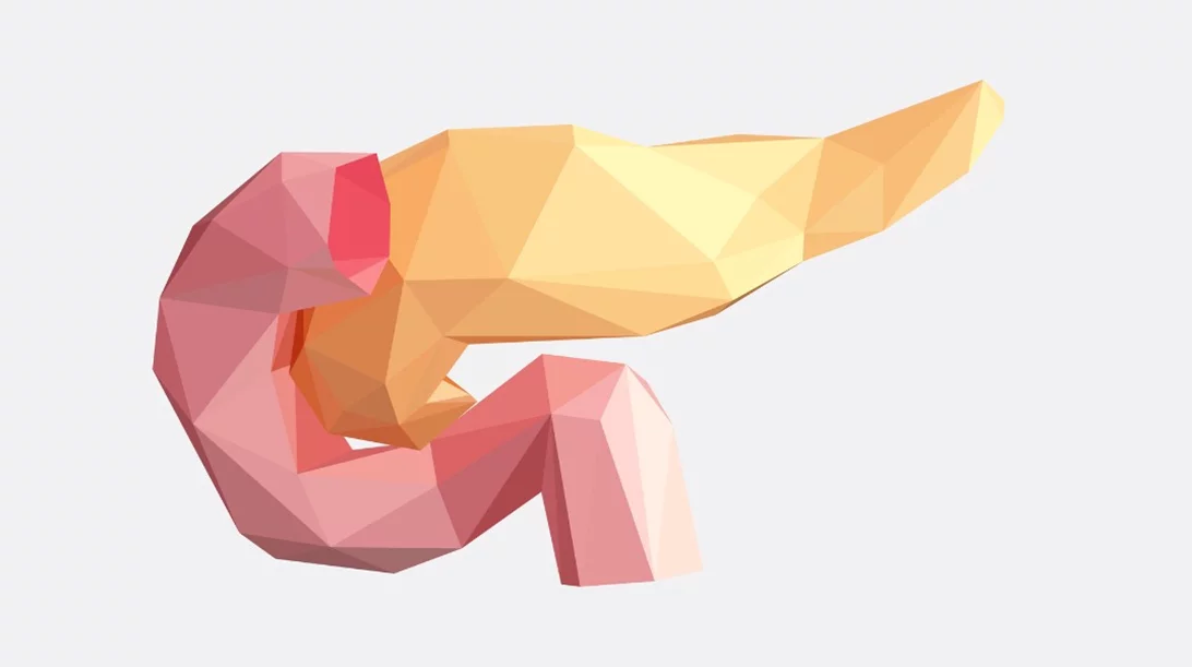 Τι είναι η οξεία παγκρεατίτιδα, τι την προκαλεί και η θεραπεία