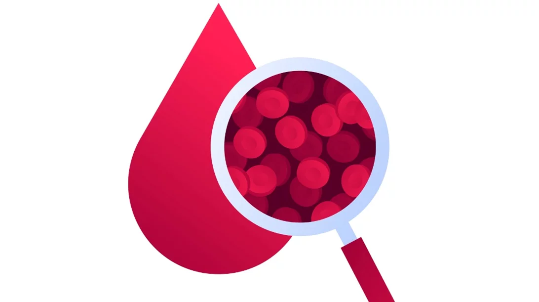 Χαμηλός αιματοκρίτης, έλλειψη βιταμινών; Τι σημαίνουν τα αποτελέσματα από τις εξετάσεις αίματος