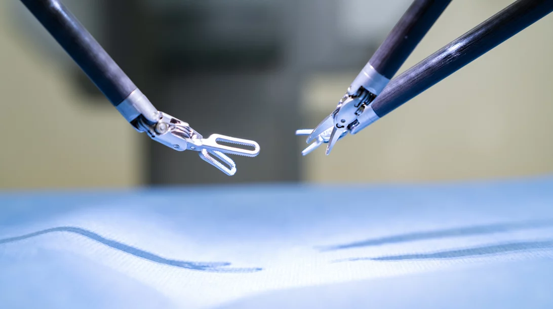 Ευρωκλινική Αθηνών: Πρωτοπορεί στη Ρομποτική Χειρουργική του καρκίνου του παχέος εντέρου με ΑΙ