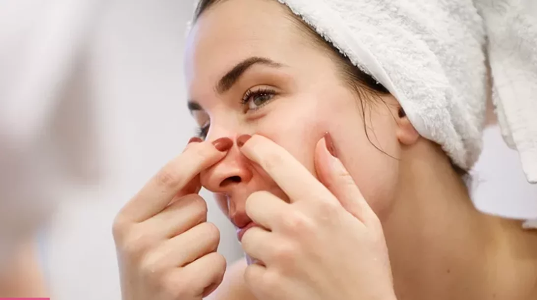 Πώς φεύγουν τα εσωτερικά σπυράκια; Τα do's και don'ts