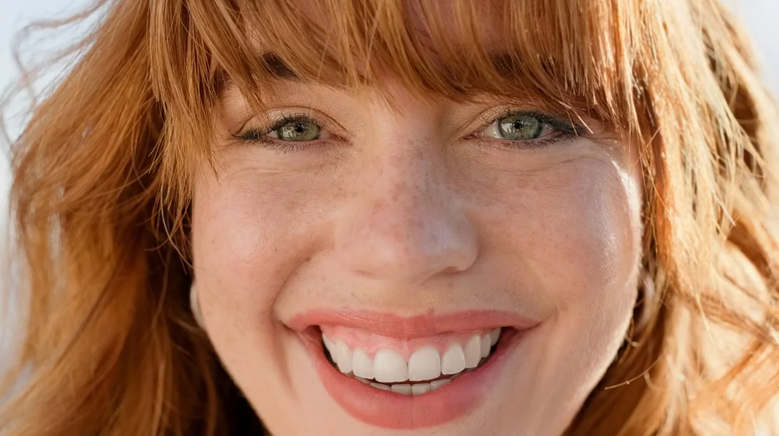 Έχεις μαύρους κύκλους; Βρήκαμε τη λύση: skincare ρουτίνα, tricks και θεραπείες που κάνουν τη διαφορά