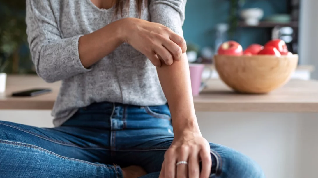 Ψωρίαση: Οι ίδιοι οι ασθενείς απαντάνε πώς επηρεάζει τη ζωή τους