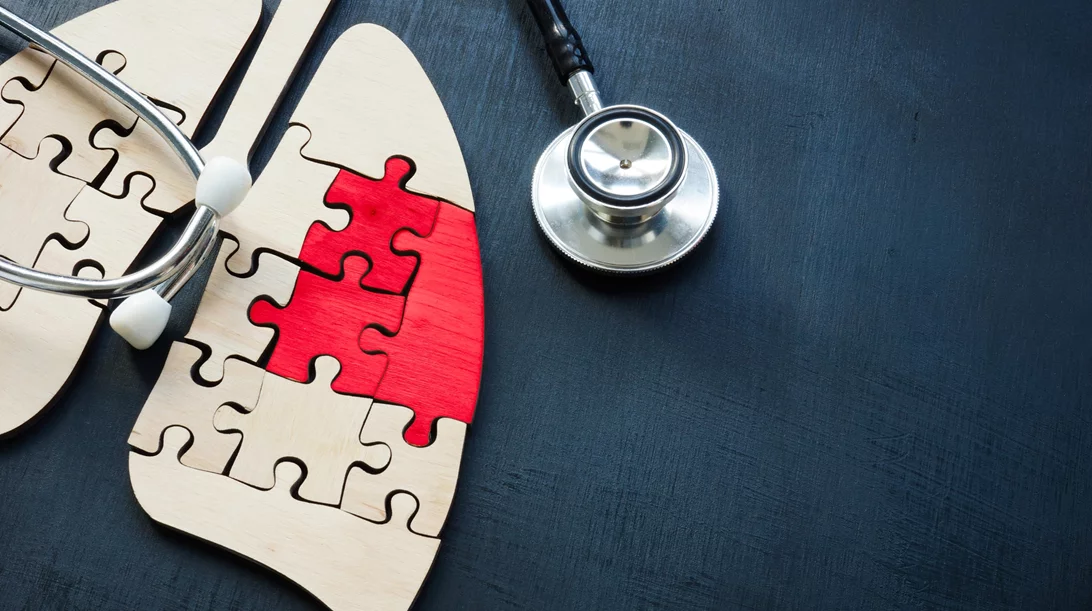 Το μέλλον είναι εδώ: Το νέο "εργαλείο" για τη διάγνωση του καρκίνου του πνεύμονα