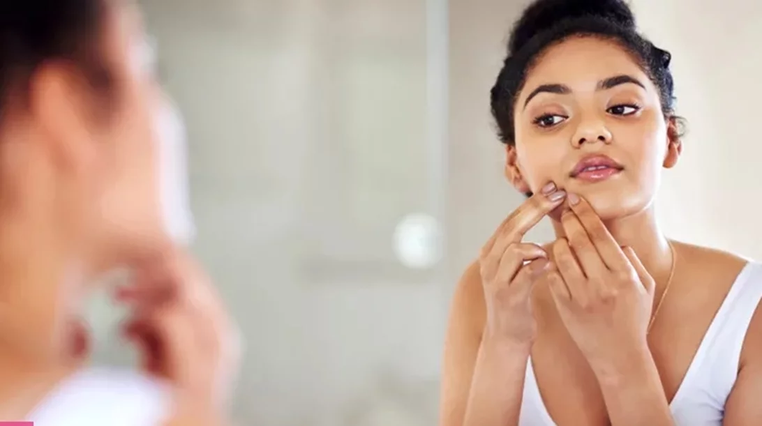 Το εγγυημένο hack μακιγιάζ που θα "σβήσει" στη στιγμή τα σπυράκια