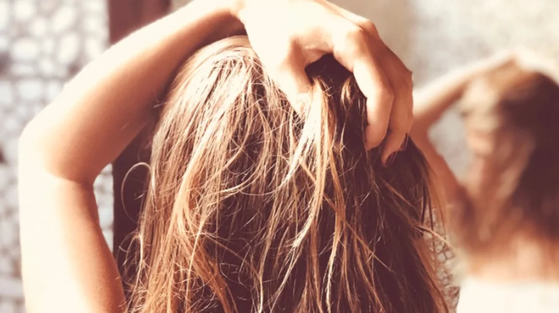 Έχω πιτυρίδα, τι να κάνω; Όσα συστήνει ο δερματολόγος για την αντιμετώπισή της