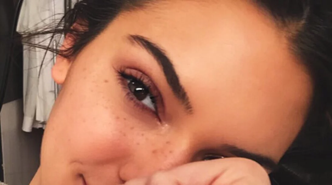 Γιατί ΔΕΝ θα δοκιμάσουμε τη σπιτική μάσκα κατά της ακμής από την Kendall Jenner