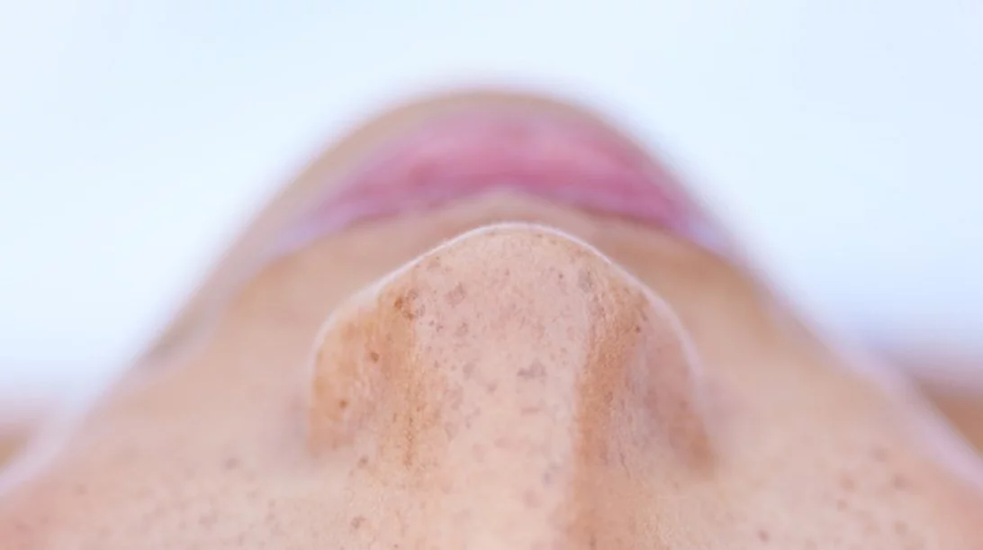 Μαύρα στίγματα στη μύτη; Δες πώς θα τα ξεφορτωθείς