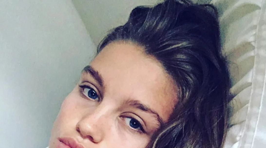 ΑΥΤΟ είναι το μπαχαρικό που χρειάζεται η επιδερμίδα σου (και τα κάνει όλα)!