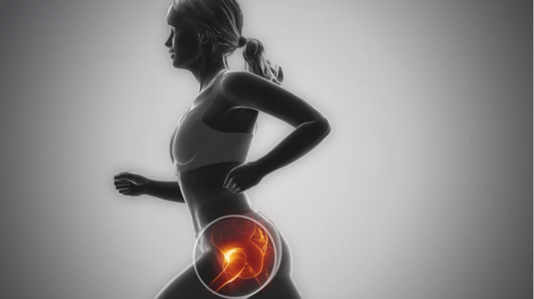 Κράτα την οστεοπόρωση μακριά με την άσκηση