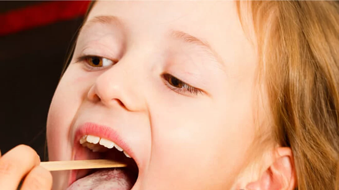 Οξεία λαρυγγίτιδα στο παιδί: Ποια είναι η σωστή αντιμετώπιση;