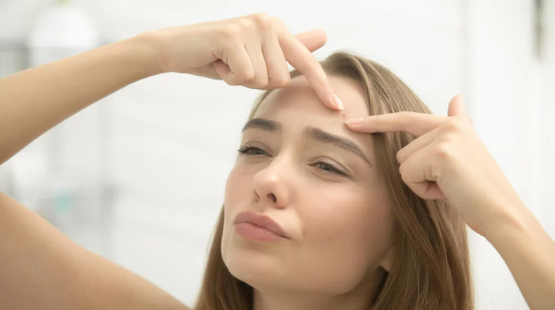 Έρχεται εμβόλιο κατά της ακμής;