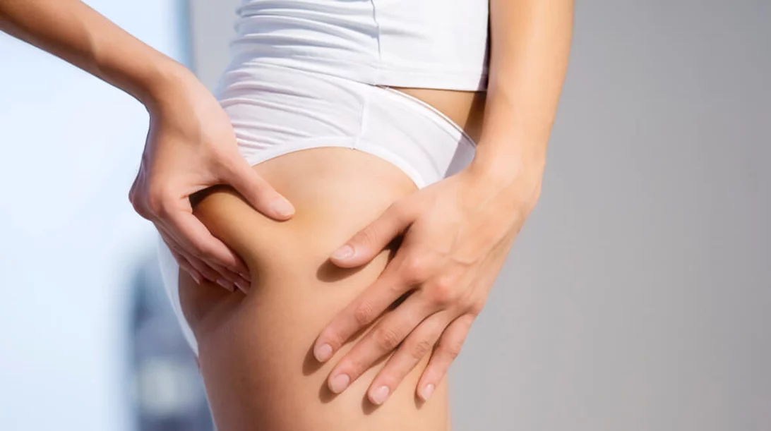 Οι δύο βασικοί λόγοι που έχεις κυτταρίτιδα και πώς θα την μειώσεις