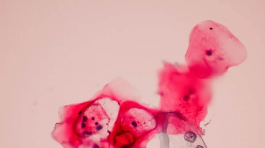 «Μην αργήσεις!» τον εμβολιασμό της κόρης σου για τον ιό HPV